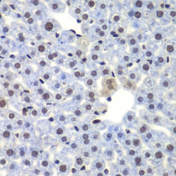 Polyclonal Rabbit anti-Human CEBPG / CEBP Gamma Antibody (IHC, IF, WB)