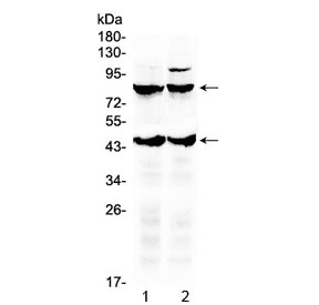 TSH Receptor / TSHR Antibody
