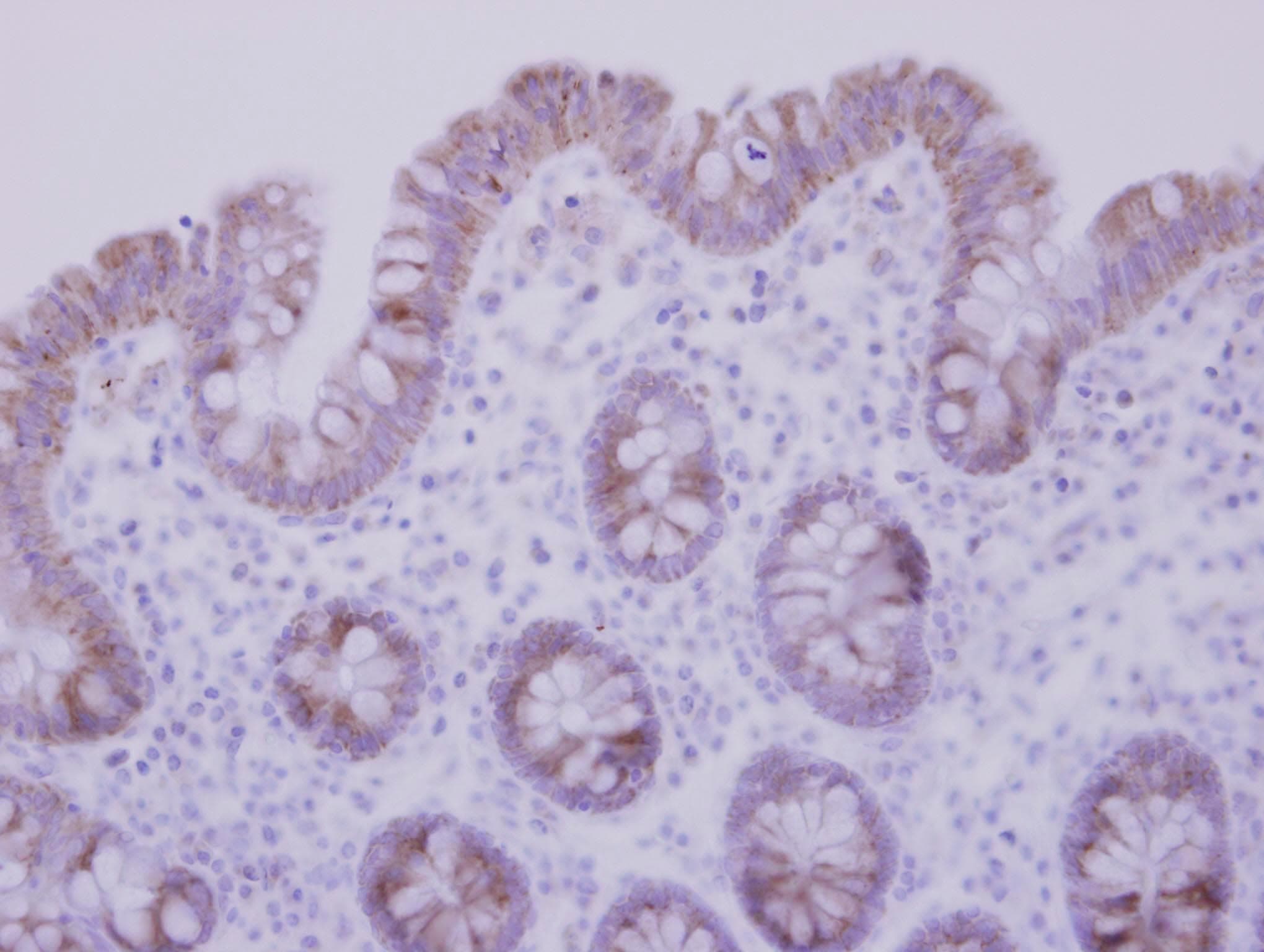 CCDC83 Antibody (aa163-397)