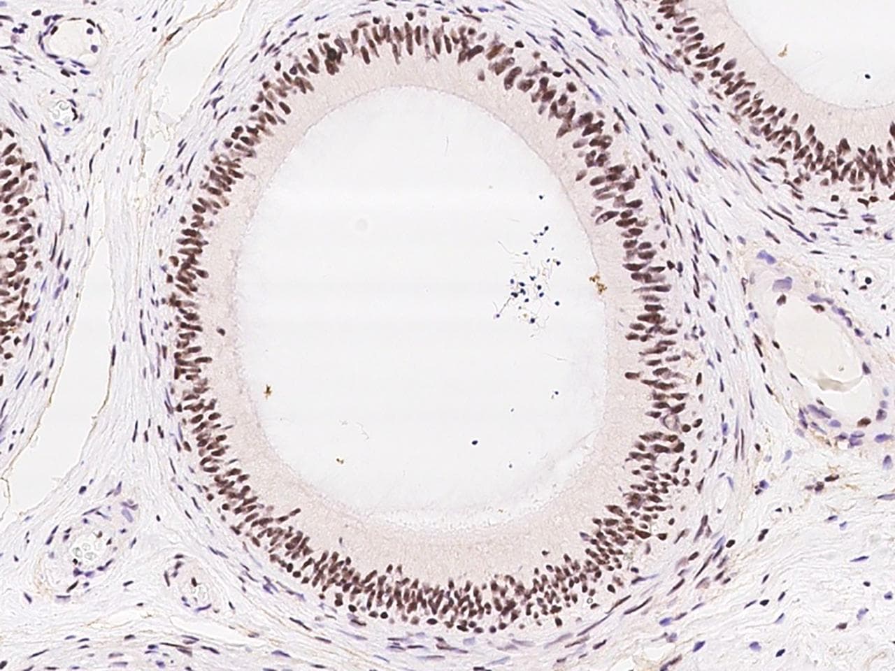 Polyclonal Rabbit anti-Human RANBP3 Antibody (IHC, IF, WB)