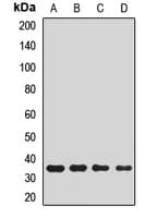 Polyclonal Rabbit anti-Human PLCXD2 Antibody (IF, WB)
