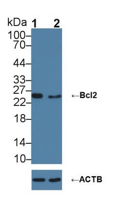 BCL2 / Bcl-2 Antibody (aa2-208)
