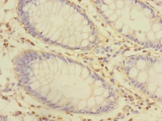 Polyclonal Rabbit anti-Human CRIP1 Antibody (IHC, WB)