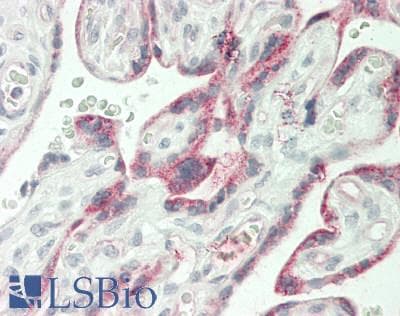 IHC-plus™ MARCH1 Antibody (Internal)