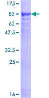 Human VPS18 Protein (Recombinant GST)