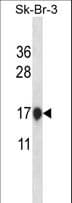 Polyclonal Rabbit anti-Human CSTB / Cystatin B / Stefin B Antibody (aa10-39, WB)