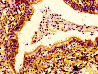Polyclonal Rabbit anti-Human ERGIC2 Antibody (IHC, IF, WB)
