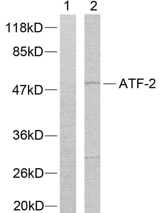 Polyclonal Rabbit anti-Human ATF2 Antibody (p73 or 55, IHC, IF, WB)
