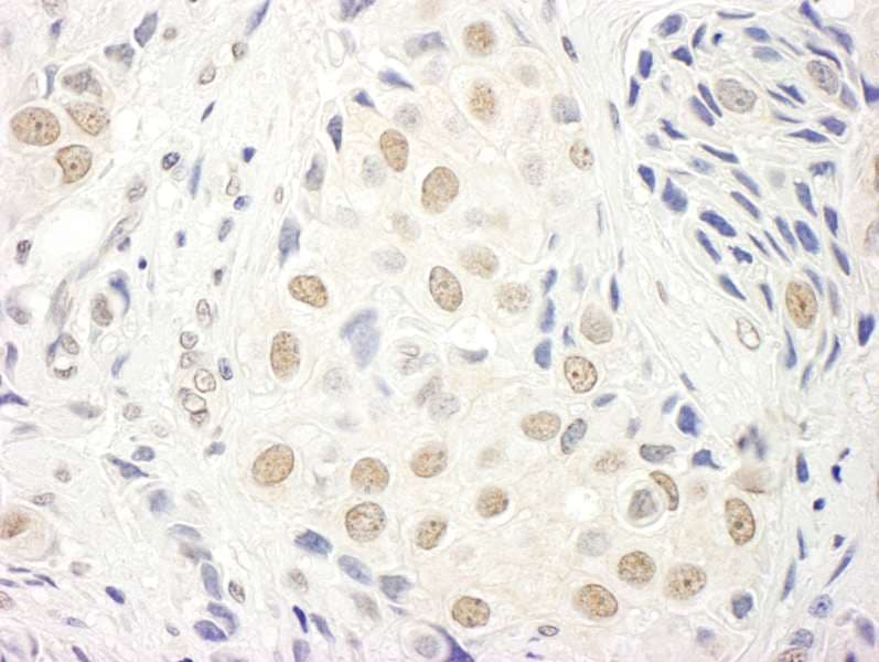 Polyclonal Rabbit anti-Human TCEA1 / TFIIS Antibody (aa1-50, IHC)