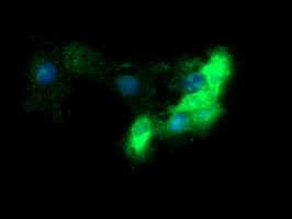 IHC-plus™ FCGR1A / CD64 Antibody (clone OTI1A8)