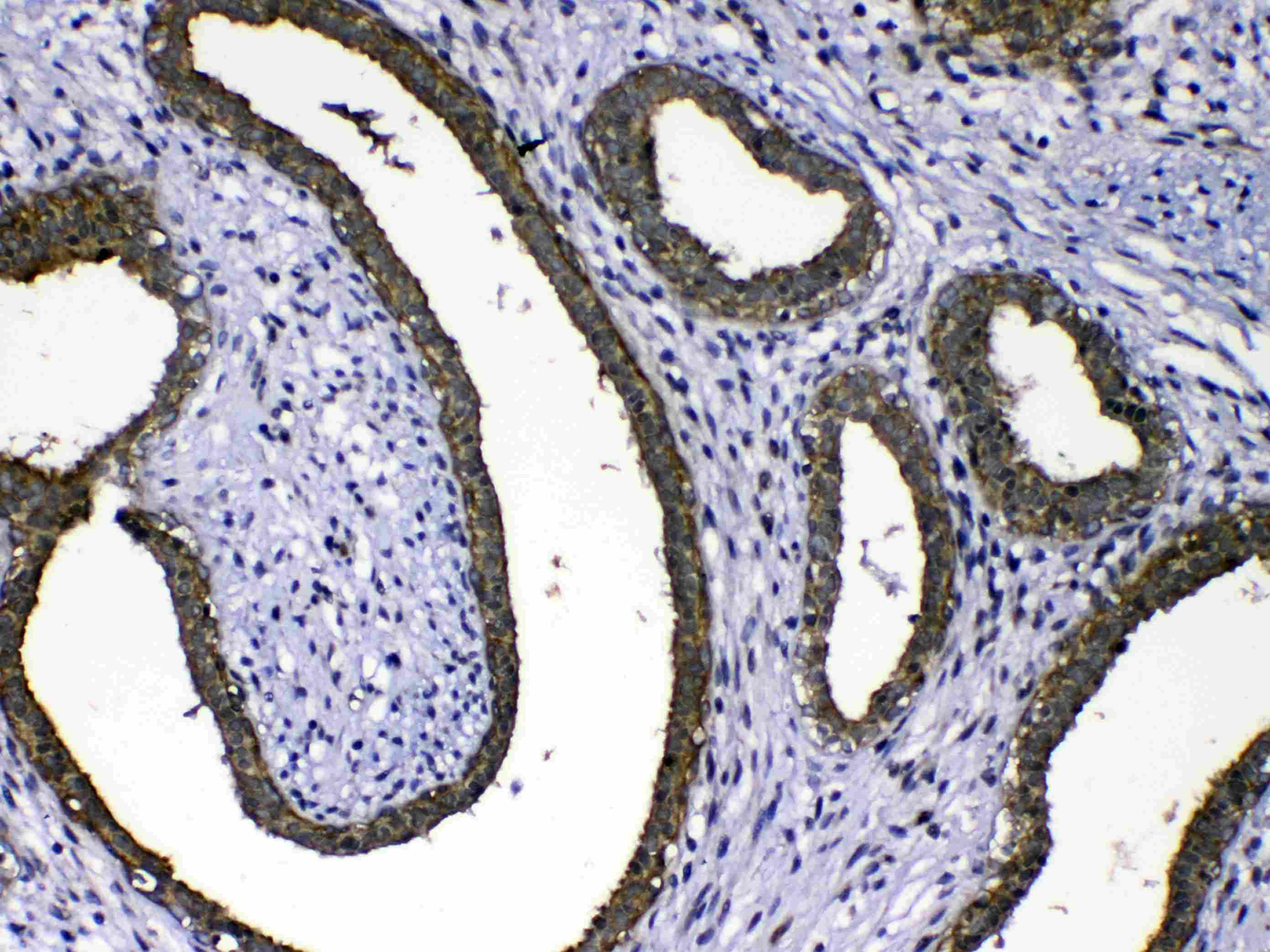 MMP16 Antibody