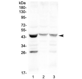 SFTPB / Surfactant Protein B Antibody