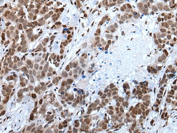 Polyclonal Rabbit anti-Human BRUNOL5 / CELF5 Antibody (IHC)