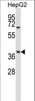 IHC-plus™ AMBP Antibody (aa77-104)