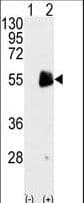 PRMT7 Antibody (aa660-692)