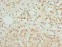 AZIN1 Antibody