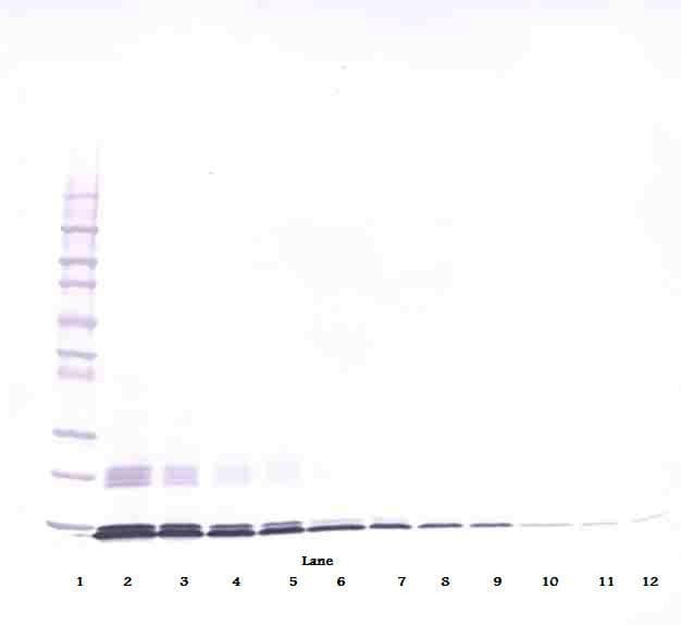 CCL2 / MCP1 Antibody