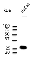 IHC-plus™ CAV1 / Caveolin 1 Antibody (N-Terminus)