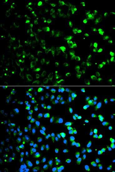 Polyclonal Rabbit anti-Human TP / Thymidine Phosphorylase Antibody (IHC, IF, WB)