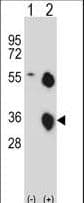 KLK8 / Kallikrein 8 Antibody (aa9-38)