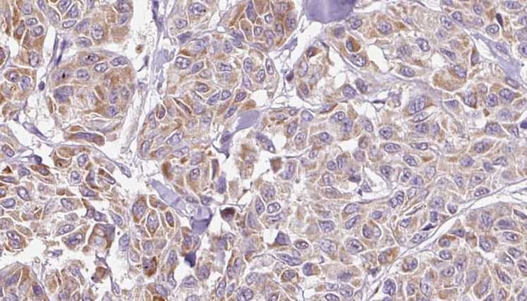 IL17C Antibody