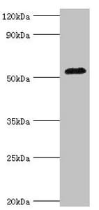 IHC-plus™ AGT / Angiotensinogen Antibody (aa35-285)
