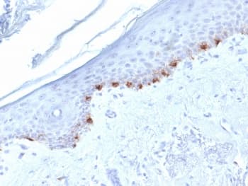 TYRP1 / gp75 Antibody (clone TYRP1/1986, Ready-to-Use)