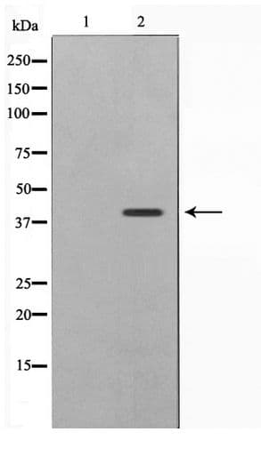 CBX6 Antibody