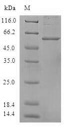 Human ANXA8L1 Protein (Recombinant GST, N-terminus)