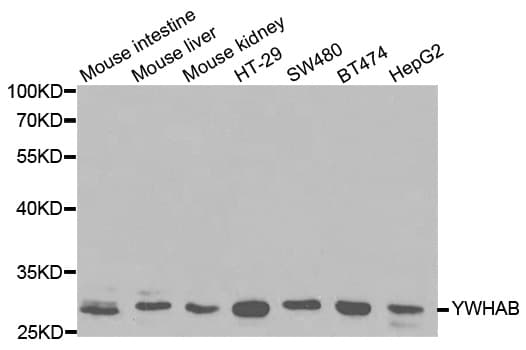 YWHAB / 14-3-3 Beta Antibody