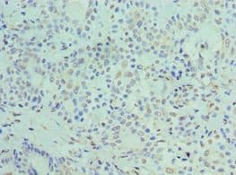PLIN2 / ADFP / Adipophilin Antibody (aa168-437)