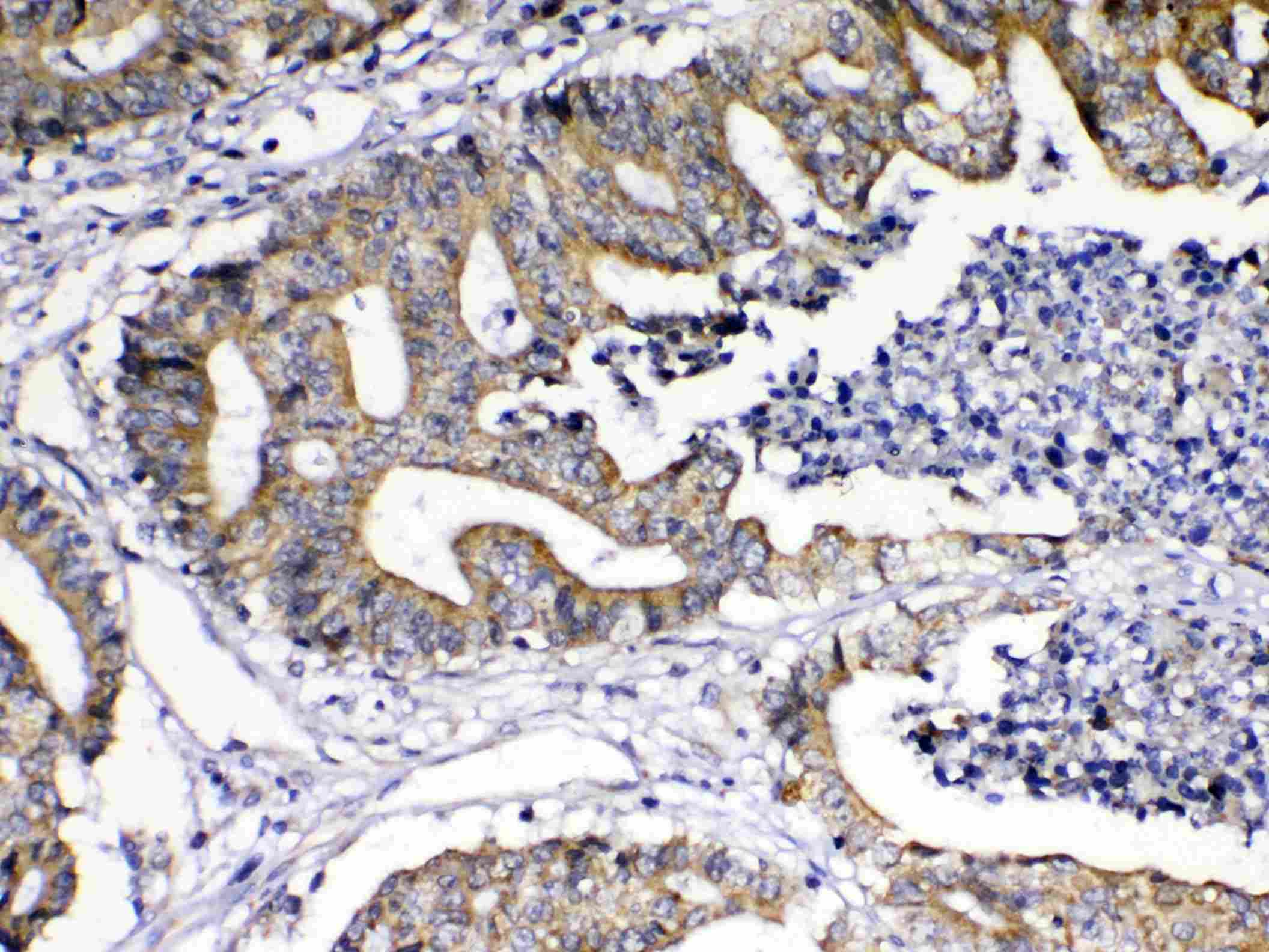 Polyclonal Rabbit anti-Human TNFSF18 / GITRL Antibody (IHC, WB)