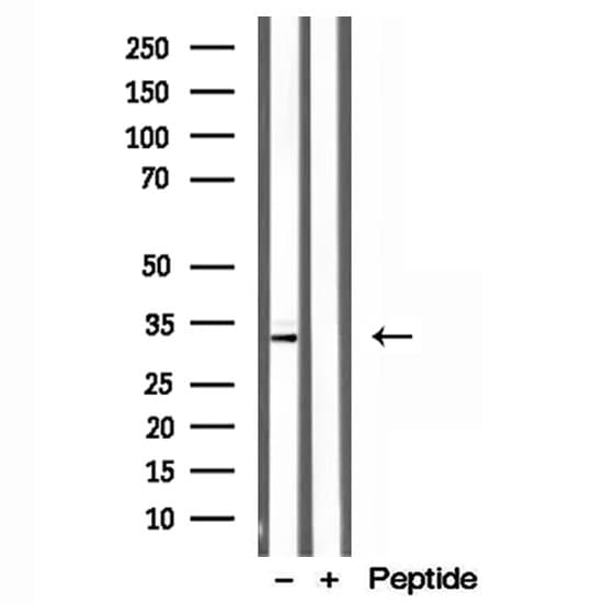 CAPZA1 / CAPZ Alpha 1 Antibody