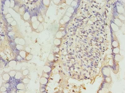 Polyclonal Rabbit anti-Human PDCD1 / CD279 / PD-1 Antibody (IHC, WB)