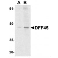 IHC-plus™ DFFA / ICAD / DFF45 Antibody