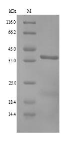 Dog ANXA13 / Annexin XIII Protein (Recombinant 6His, N-terminus)