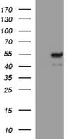 MMP13 Antibody (aa104-471, clone OTI3G1)