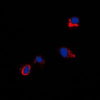 CXADR Antibody (N-Terminus)