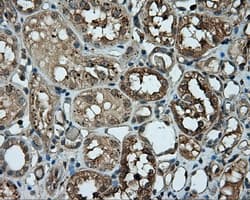 PIM2 / Pim-2 Antibody (clone OTI10A12)