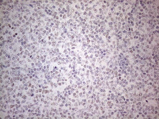 IRS1 Antibody (aa1-280, clone OTI2B10)