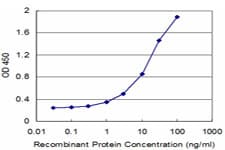 LMX1B Antibody (clone 1D12)