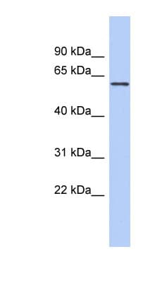 PDE4B Antibody (aa467-516)