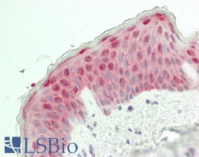 IHC-plus™ MOV10 Antibody (aa953-1003)