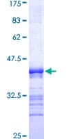 Human PEAK1 / SGK269 Protein (Recombinant GST, N-terminus)