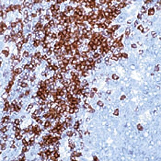 Polyclonal Rabbit anti-Human CD3 Antibody (IHC)