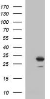 Placental Lactogen Antibody (clone OTI2G4)