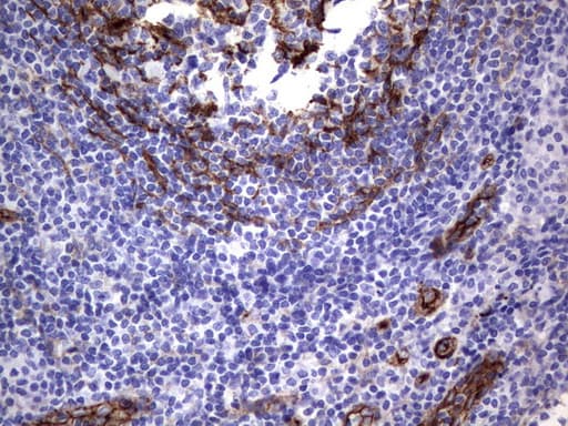 MCAM / CD146 Antibody (clone UMAB154)