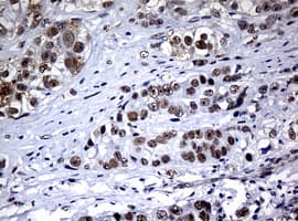 Monoclonal Mouse anti-Human NBN / Nibrin Antibody (clone OTI2G4, IHC, WB)