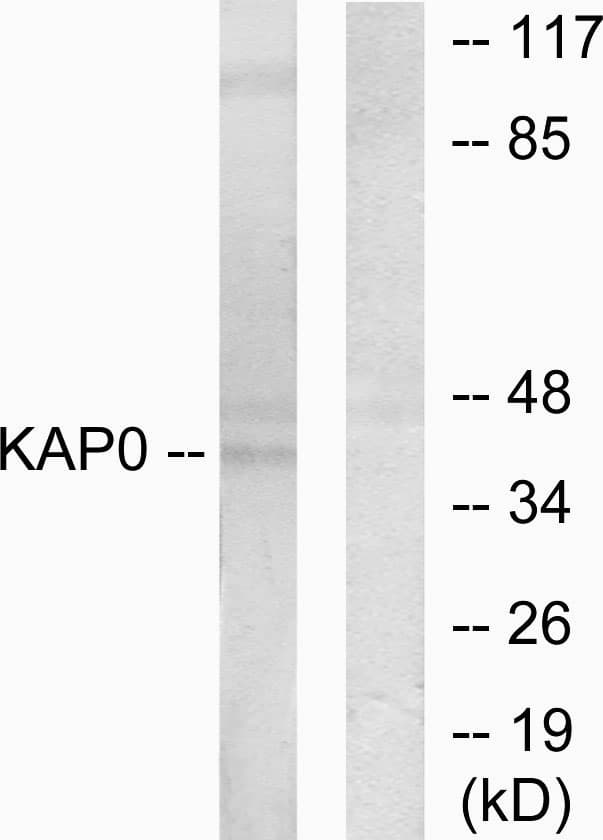 Polyclonal Rabbit anti-Human PRKAR1A Antibody (aa271-320, WB)