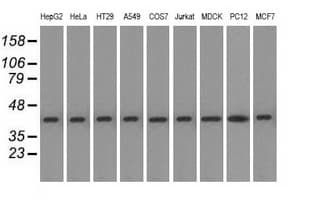 ACAT2 Antibody (clone OTI1B7)